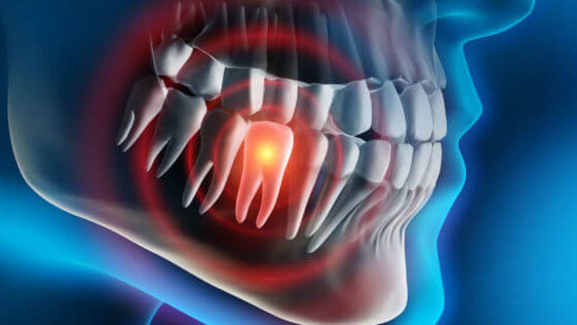 Mikroszkópos gyökérkezelés Budapesten biztonságosan Mikroszkópos gyökérkezelés Budapest hatékonyan