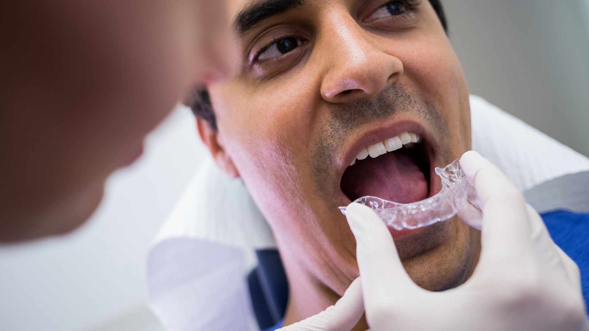 Invisalign vagy fogszabályozó – Melyiket válasszam?