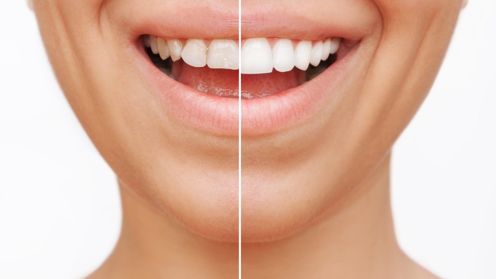 Fogászati kezelés Budapest Fogászati kezelés Budapest