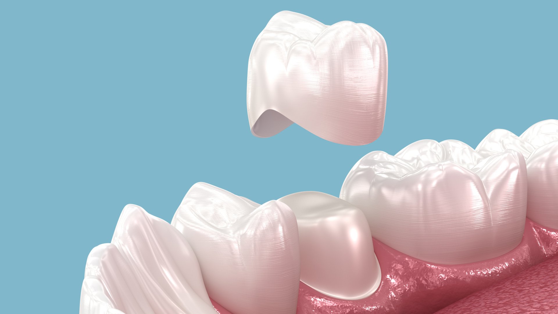 cirkon korona cirkon korona