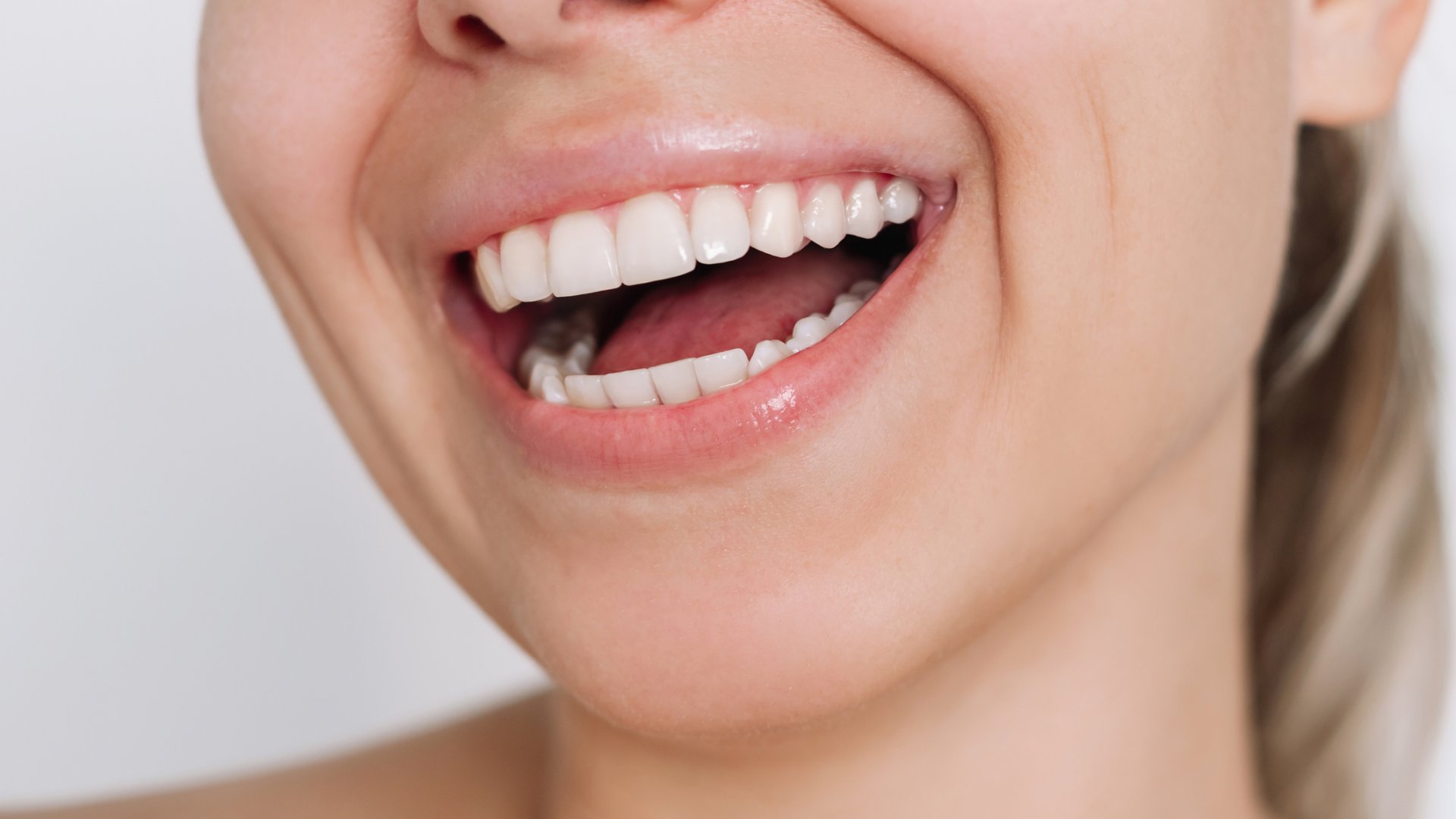 teljes fogászati implantáció teljes fogászati implantáció