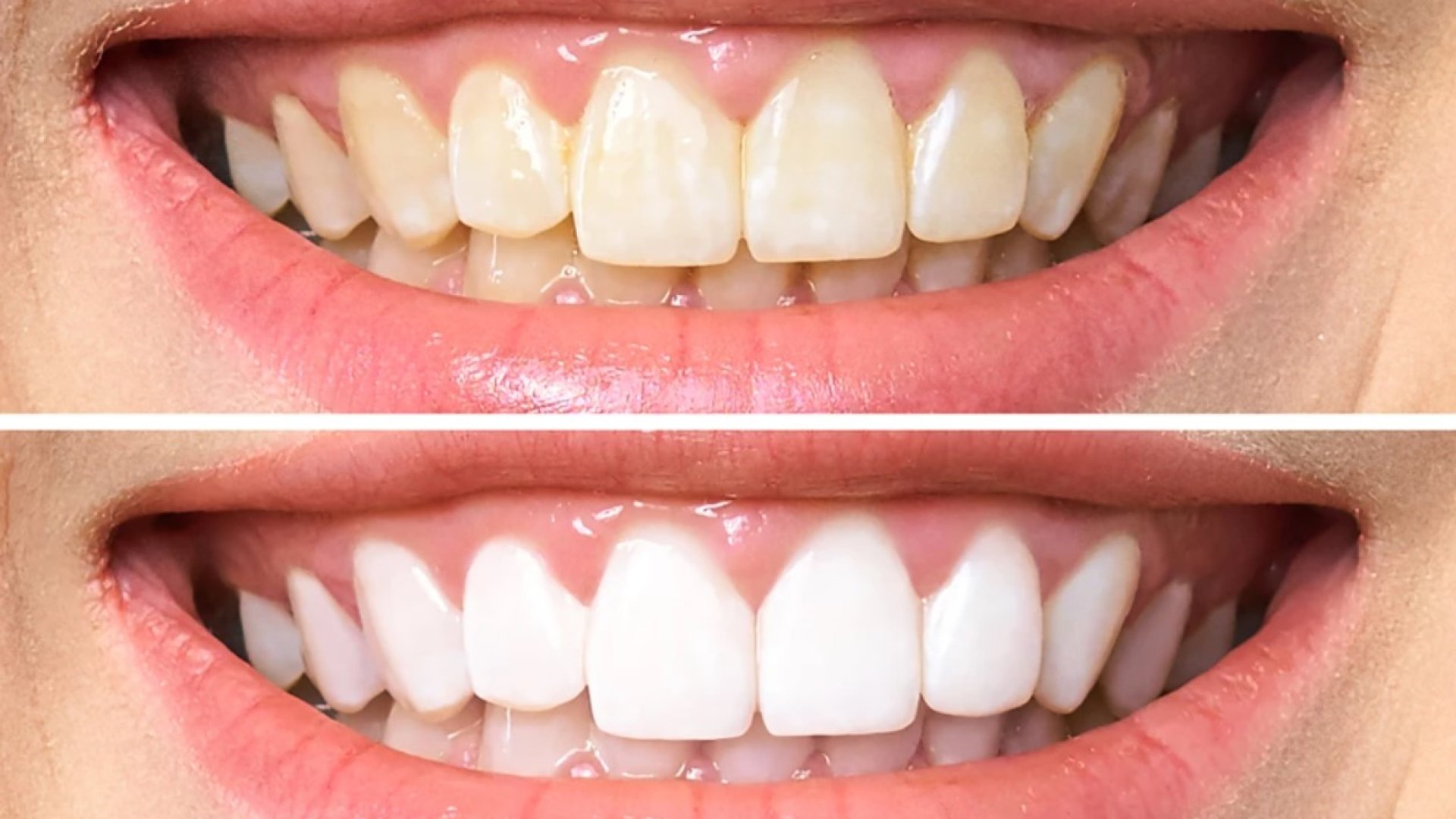 Aesthetic dental treatments