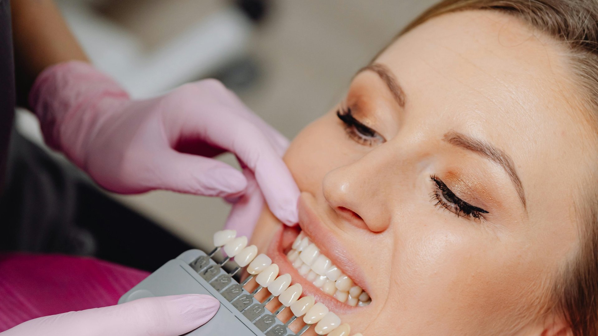 Aesthetic Problems with Your Teeth? A Dental Crown Might Be the Perfect Solution Aesthetic Problems with Your Teeth? A Dental Crown Might Be the Perfect Solution