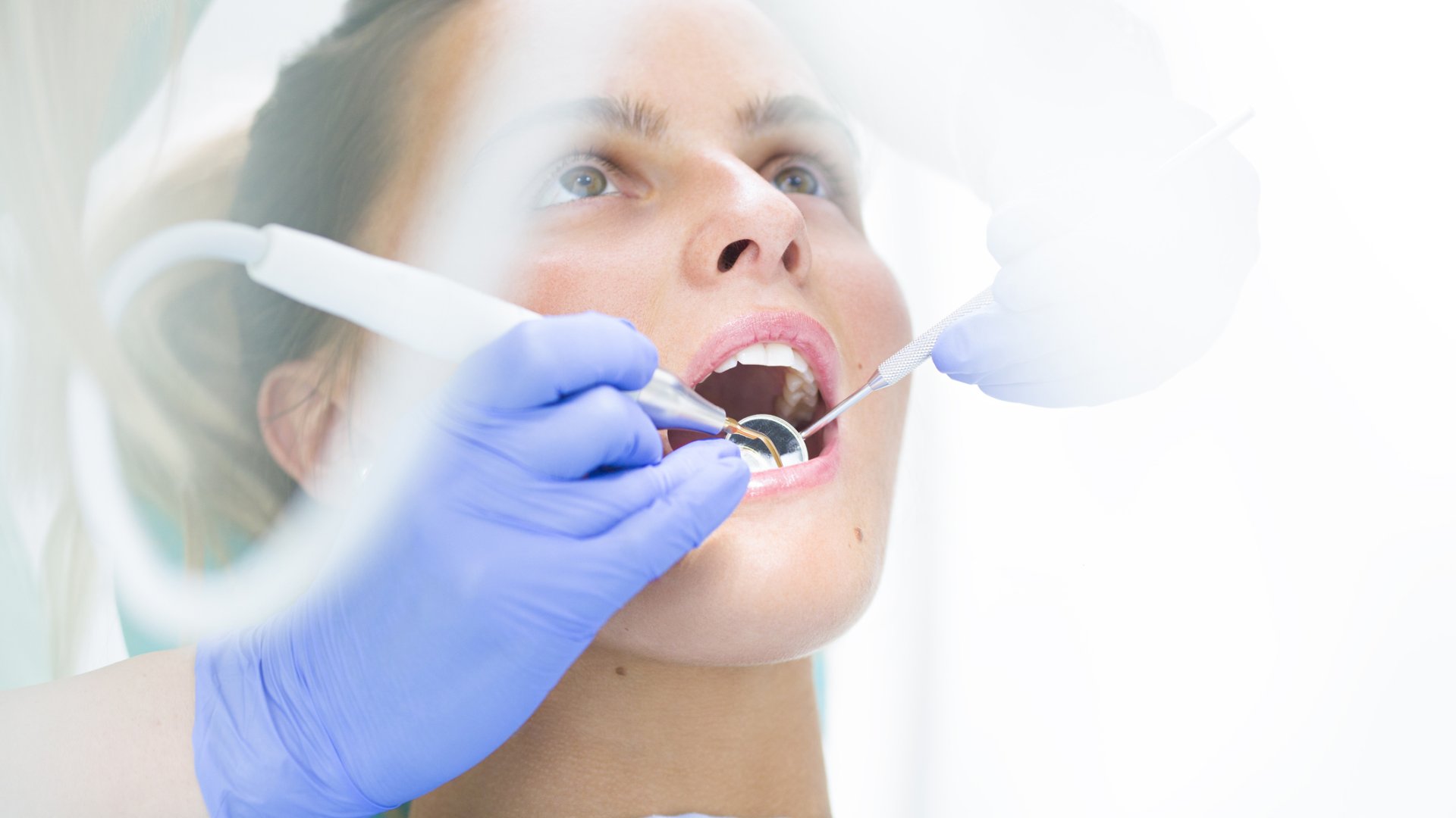 Milyen esetekben lehet szükség a fogtömésre?