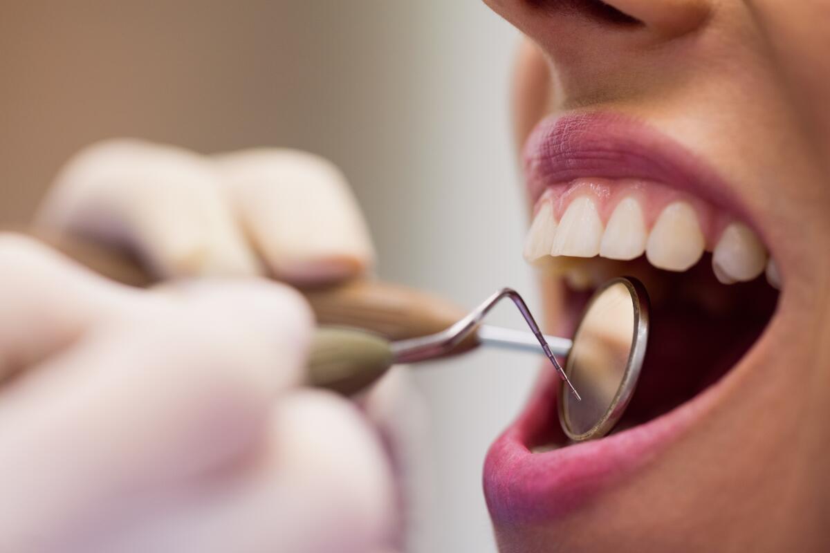 Mitől alakulhat ki a fogszuvasodás? A szuvas fogak okai 
